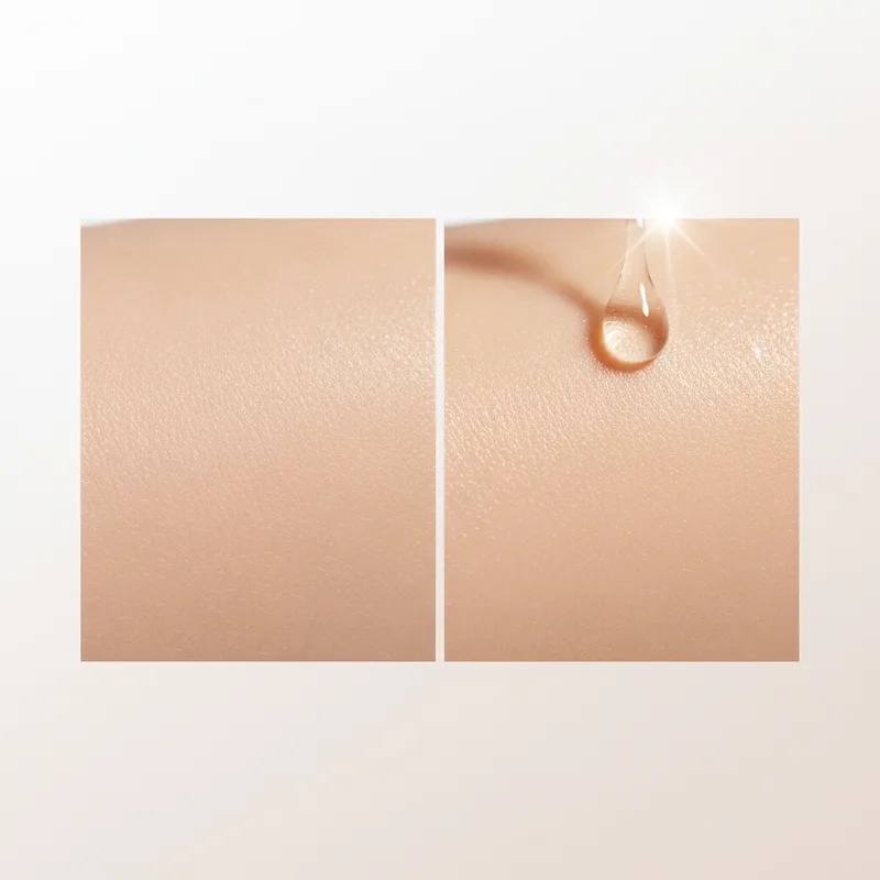 Acide hyaluronique : bienfaits pour la peau